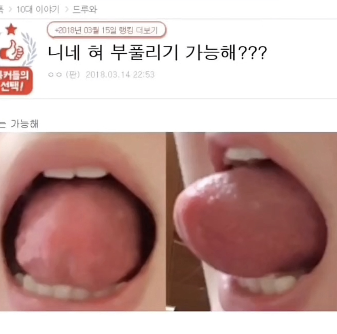 풍선처럼 혀 부풀리기.jpg